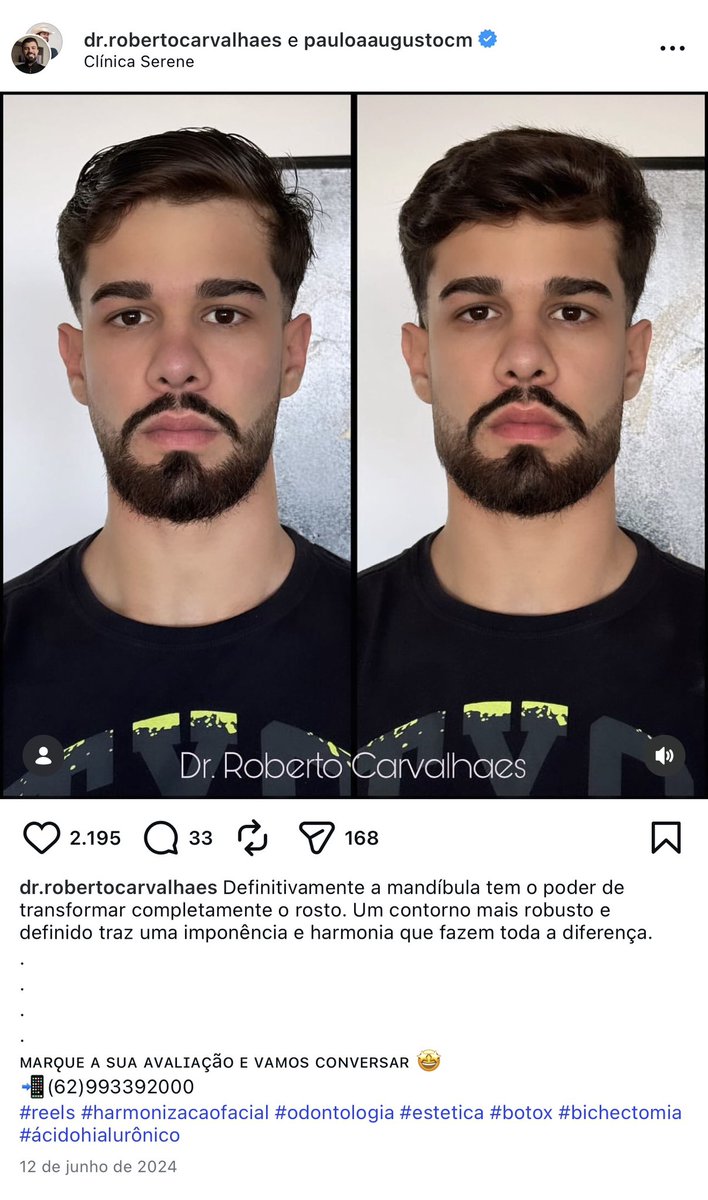 Victor_dsn's tweet image. Chocado q o Paulo Augusto é todo harmonizado.