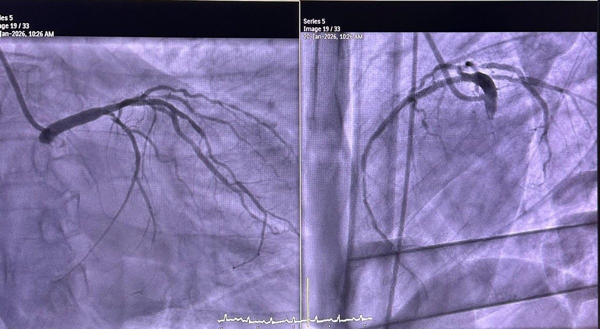 Fawaz Bardooli, MD tweet media
