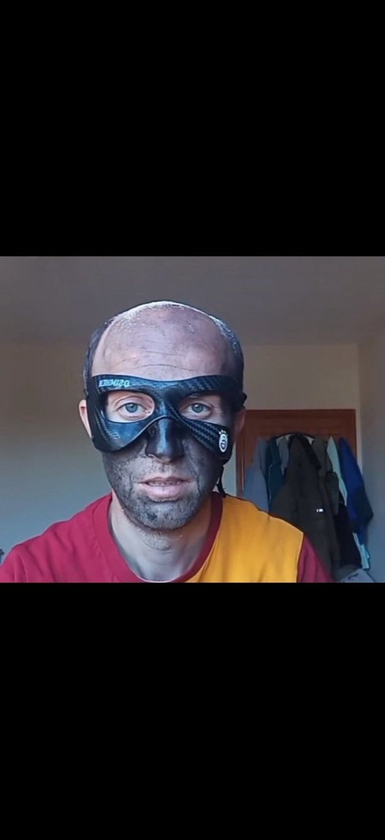 Maçta Osimhen 

#GSvATL