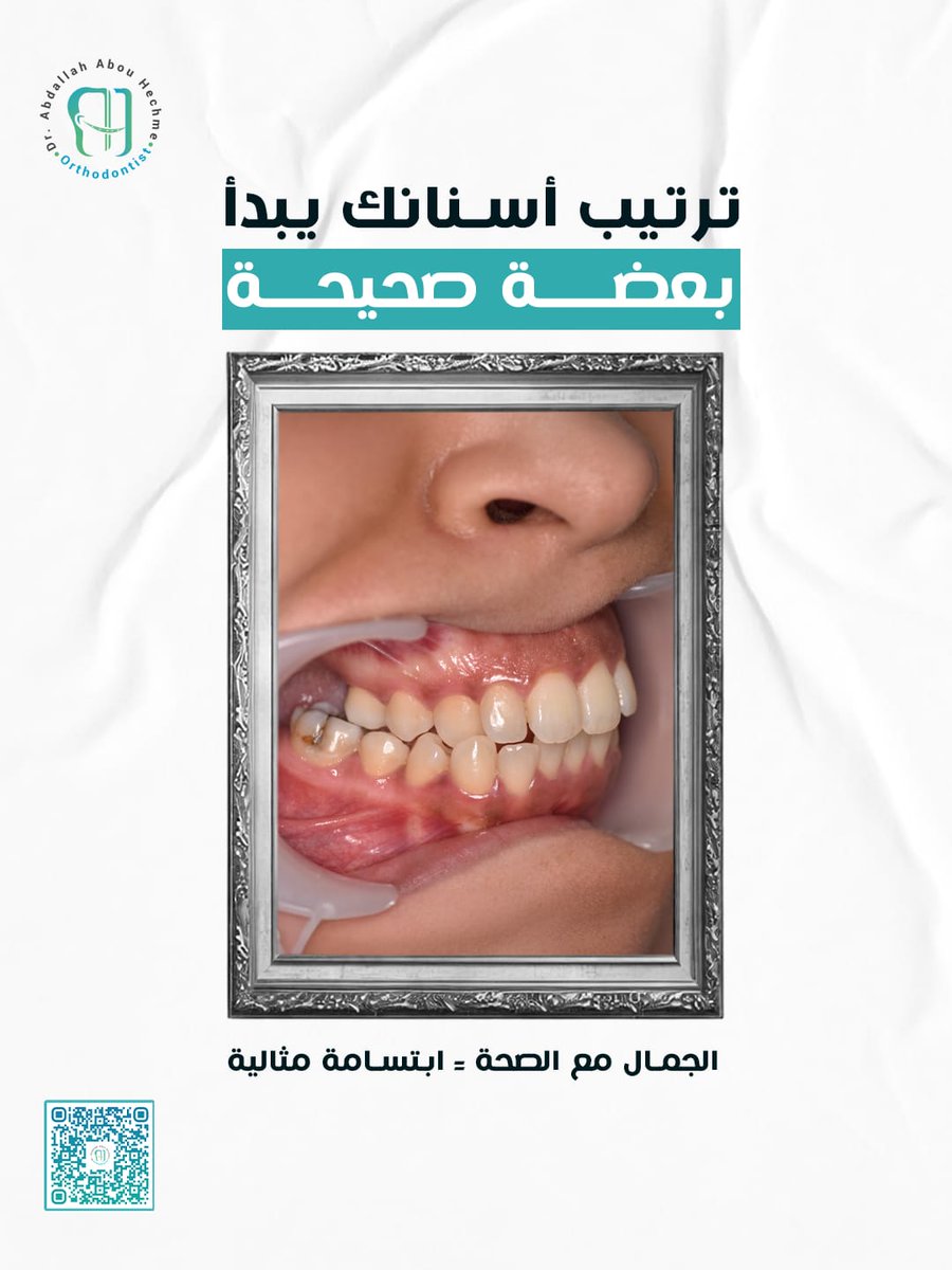 ابتسامتك تستاهل تكون في أحسن صورة 😁
حتى لو أسنانك شكلها مرتب، العضّة لو مش مظبوطة ممكن تسبب مشاكل مستقبلية للفك واللثة والأسنان!
✨ التقويم صحته مش تجميل بس…
هو استثمار في راحة فمك وصحتك على المدى الطويل 😉

#تقويم_أسنان #عضة_غير_منتظمة #تجميل_الأسنان #دكتور_تقويم