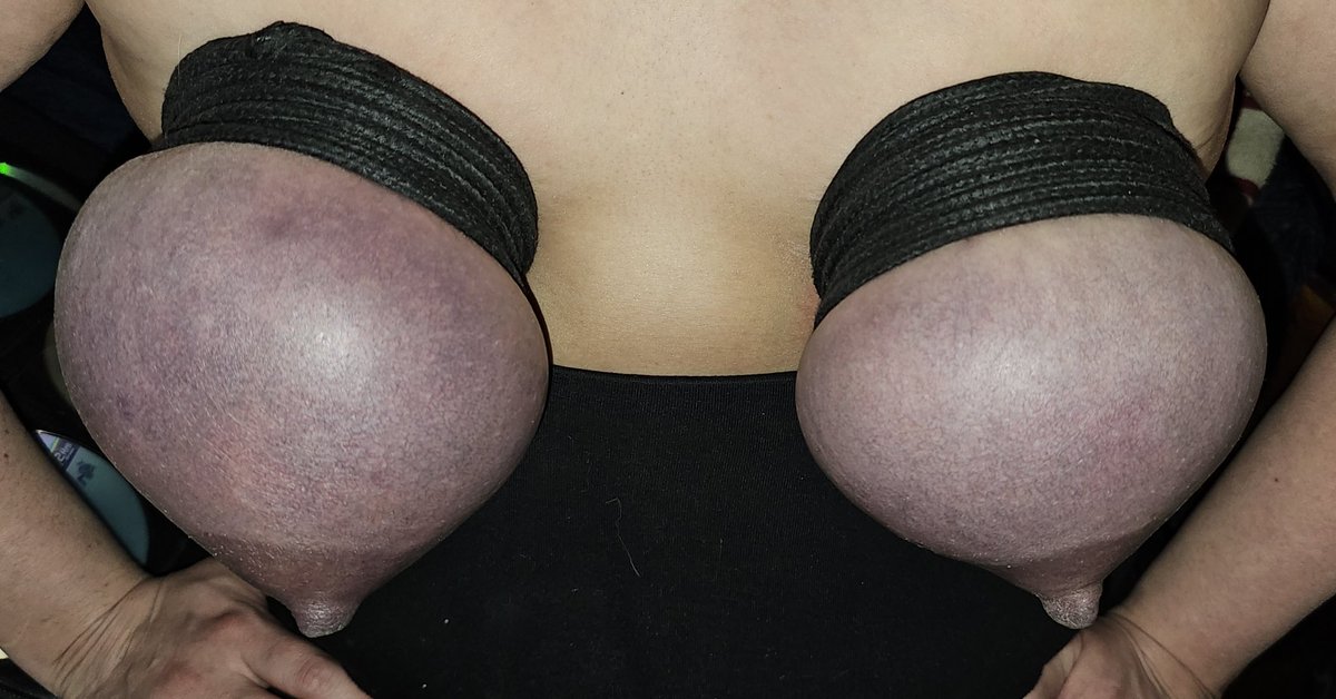 BreastBondage tweet media