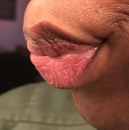 passando por aquela de fazer amizade com uma menina hétero que acha que eu super daria certo com o único amigo gay dela