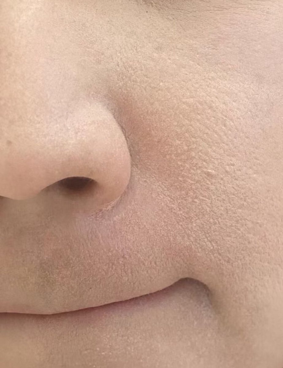 json_makes's tweet image. ガチイケ目指すための肌改善

ファンデーション塗るとこういう砂嵐肌になる人
講習やってでもこうなってる人が結構いる

・まずはメイク前化粧水、乳液、クリームなどで保湿しっかり。水分量か油分が足りてないかを明確に
・適宜ファンデーションもデパコスにアップデートしてみる…