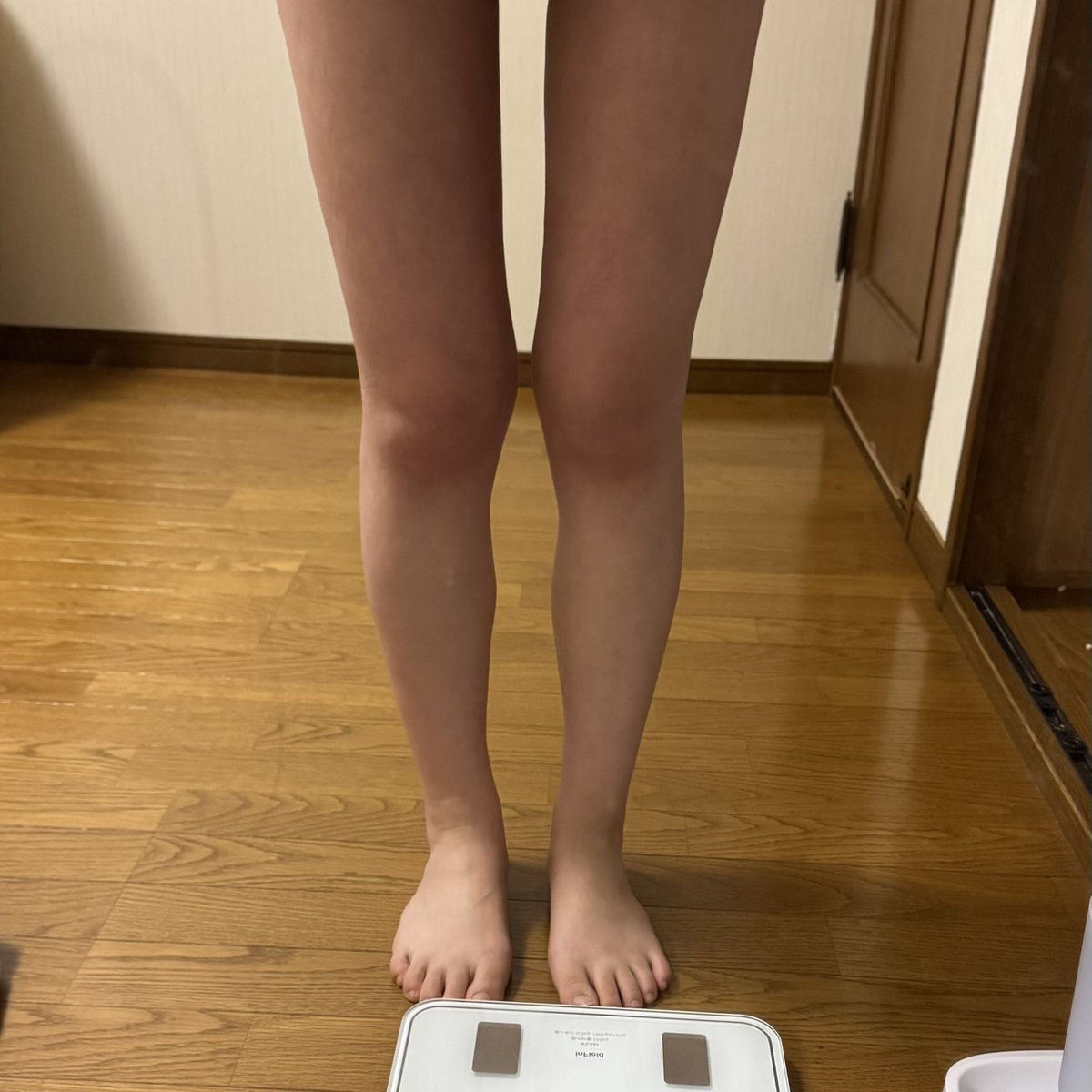 L_11onna's tweet photo. 脂肪吸引から1ヶ月
アザもなくなり、つっぱり感もマシになってしゃがめるように✨
膝の浮腫がまだひどい💦
インディバ3回行ってきて、週一で継続予定♡
もうちょっと細くなるみたいなので気長に待とう。
最近は1万歩毎日歩いてる❣️ https://t.co/QwNUEM1VKv
