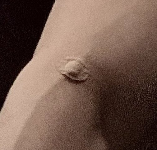 la manera en la que la enfermera debió amar ese brazo no tiene nombre