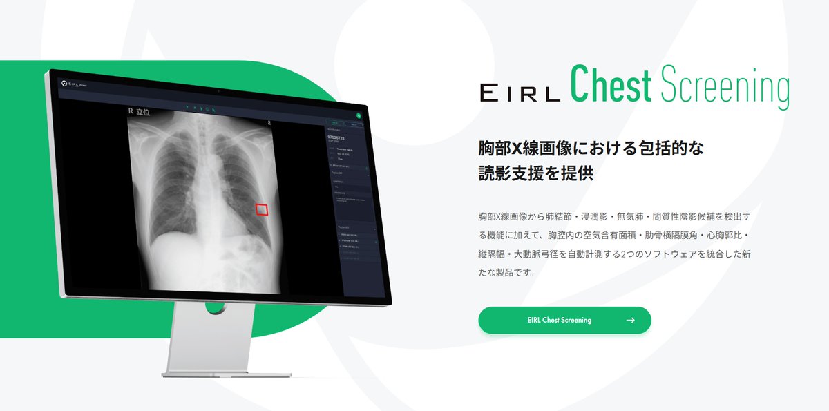 saiota_hp's tweet photo. ／
こんにちは
＼
 健診時の胸部X線検査に診断支援AI「EIRL（エイル）」を導入しました
AIが画像を解析し、肺がんなどの異常の可能性を医師に知らせ、診断をサポートします

より正確で安心な健診のため、今後も新しい技術を積極的に取り入れてまいります
#健診胸部X線 #AI #EIRL #医療DX #安心の医療 https://t.co/Lg8VvKZ6Ls