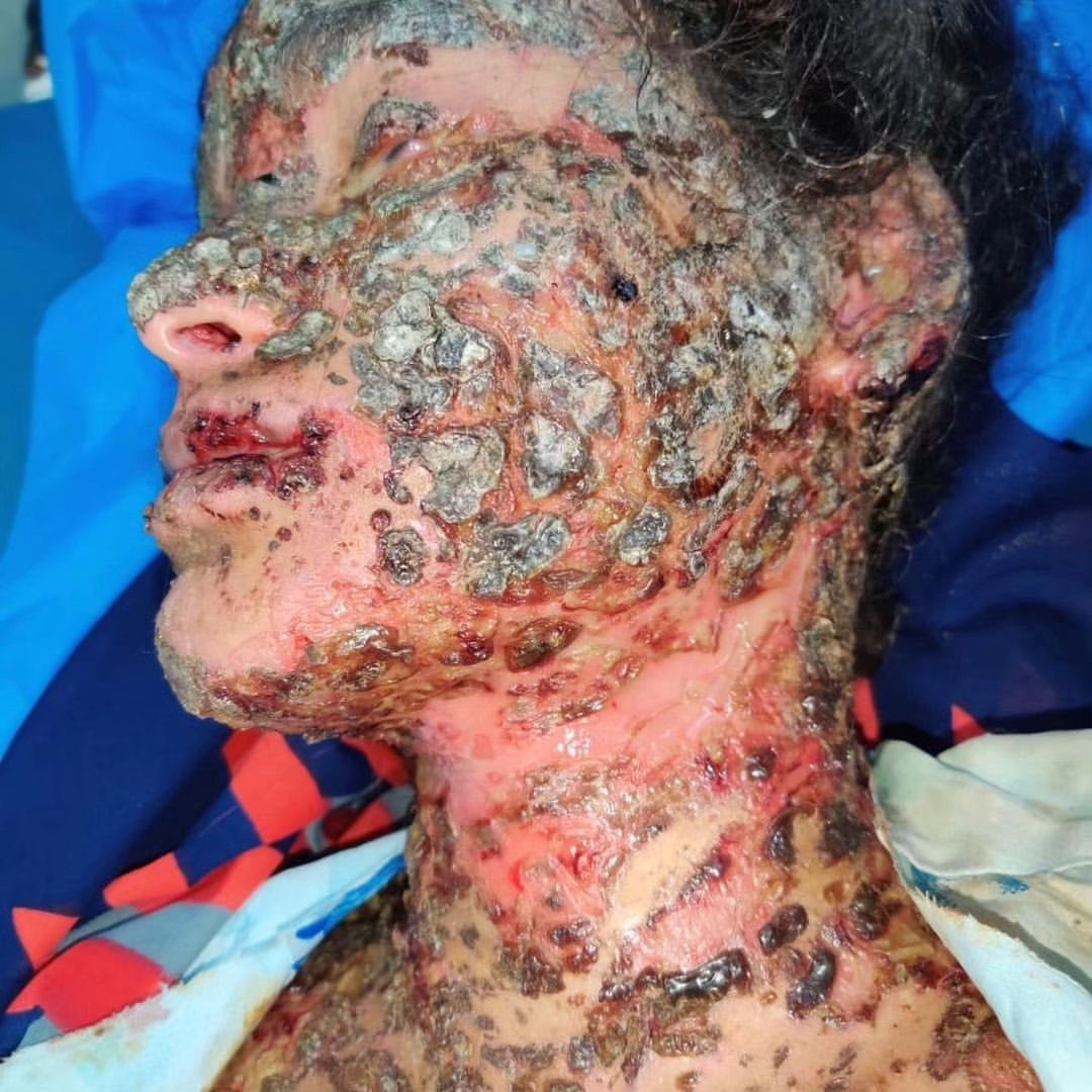 Dr Honey choudhary 🩺 tweet media