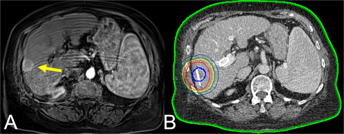 CVIR Oncology tweet media