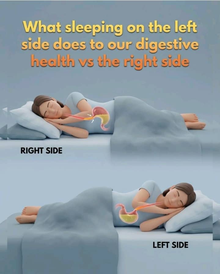 remy68928's tweet photo. #medicalsciences shows sleeping on your left sides significantly improves digestion and reduces #acidreflux due to good position #conversely opting for your right side sleep may inadvertently trigger digestive distress because stomach's position is relative to that of esophagus. https://t.co/cnj5SpdqqF