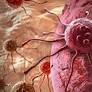 Chemistryaward's tweet image. Understanding tumor growth patterns helps guide treatment after lung cancer
More Information: research-chemistry.blogspot.com
#sciencefather #researchemistry #biochemistry #scientist #professor #phd #awards #tags #science