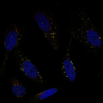 Human Protein Atlas tweet media