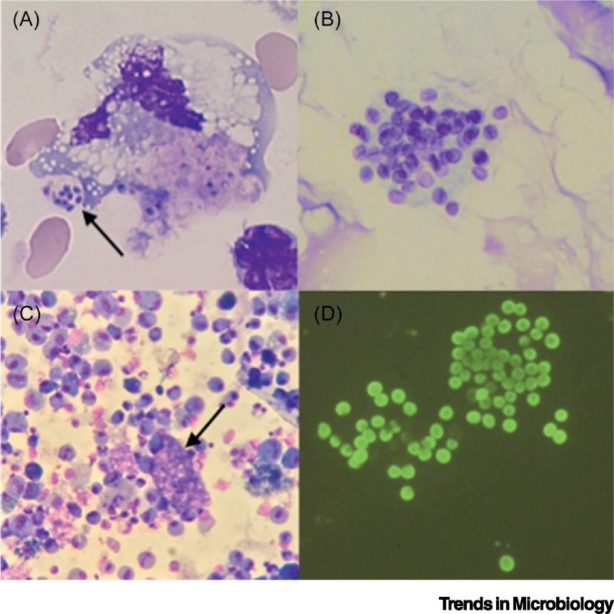 Pneumocystis jirovecii | Trends in Microbiology

(cell.com/trends/microbi…)