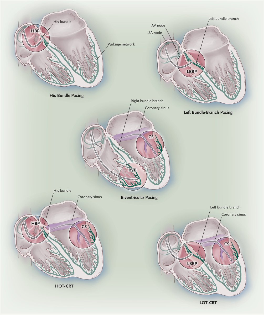 Giuseppe Biondi-Zoccai tweet media