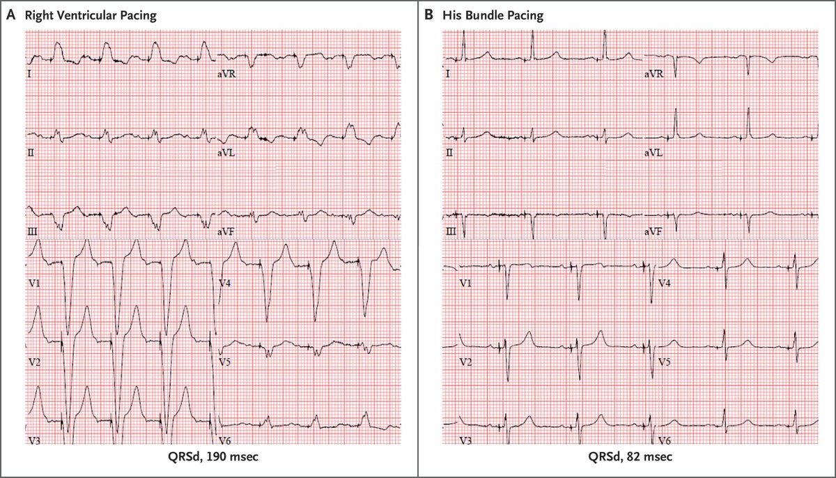 Giuseppe Biondi-Zoccai tweet media