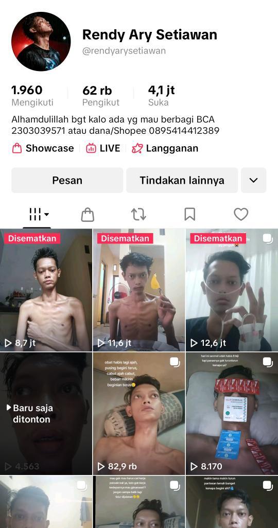 baseconvo's tweet image. 🤍 Gais ada yg tau abg ini? Dia sakit komplikasi gtu Dia sebatangkara. Berobt pakai bpjs tpi dia ttp hrs bayr kehidupn sehari2 sm bayr kostny, bln ini bln terakhir utk ngekost kykny ketrbatasn biaya. Bantu up ya gais biar dilirik pemerintah/influencer &amp;amp; bnyk yg bantu🥺