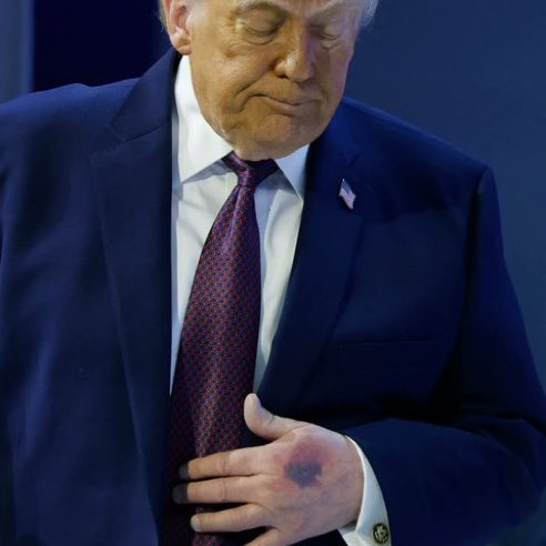 mattmfm's tweet image. There was a time when clear physical and cognitive decline in a sitting U.S. President would trigger nonstop news headlines.