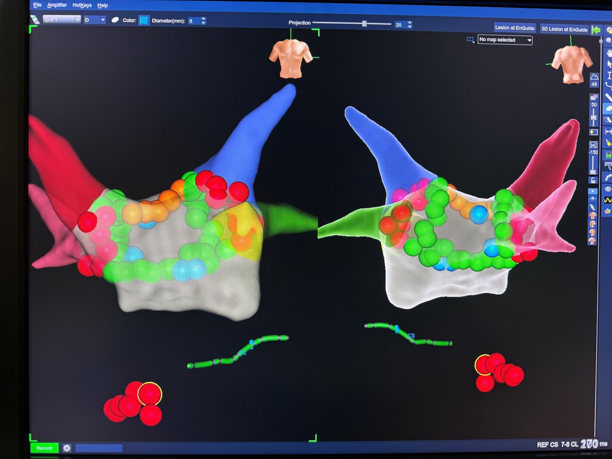 CardioFocus tweet media