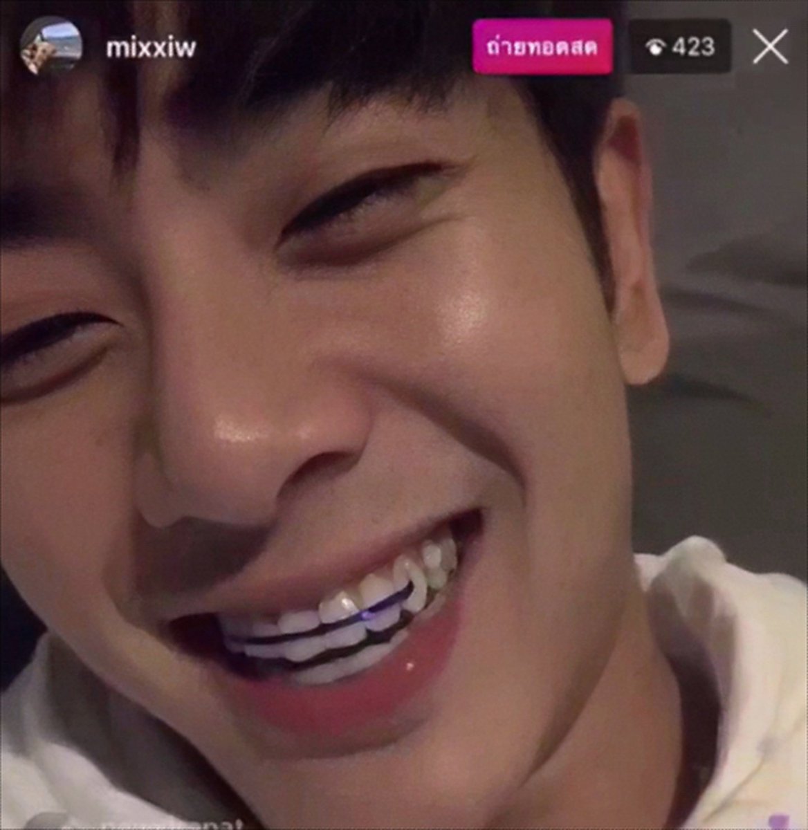 _0429x_'s tweet image. พิ่มิกกับรีเทนเนอร์ดิวะ