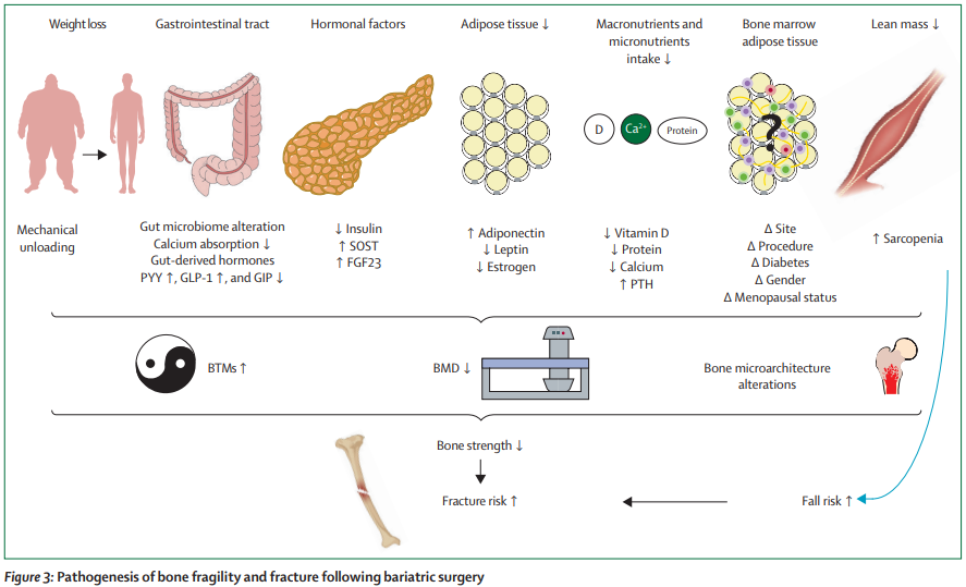ลดนน.ดีต่อสุขภาพ แต่ถ้าลดเร็วเกินไป เสี่ยงกล้ามเนื้อลด (sarcopenia) และกระดูกบางลงได้ ป้องกันโดย
- ตั้งเป้าลดช้าๆ 0.5-1 กก./สัปดาห์
- กินโปรตีนดี และแคลเซี่ยมให้เพียงพอ
- ตากแดดอ่อนๆ เสริมวิตามินดี
- ออกกำลังสร้างกล้ามเนื้อร่วมด้วย