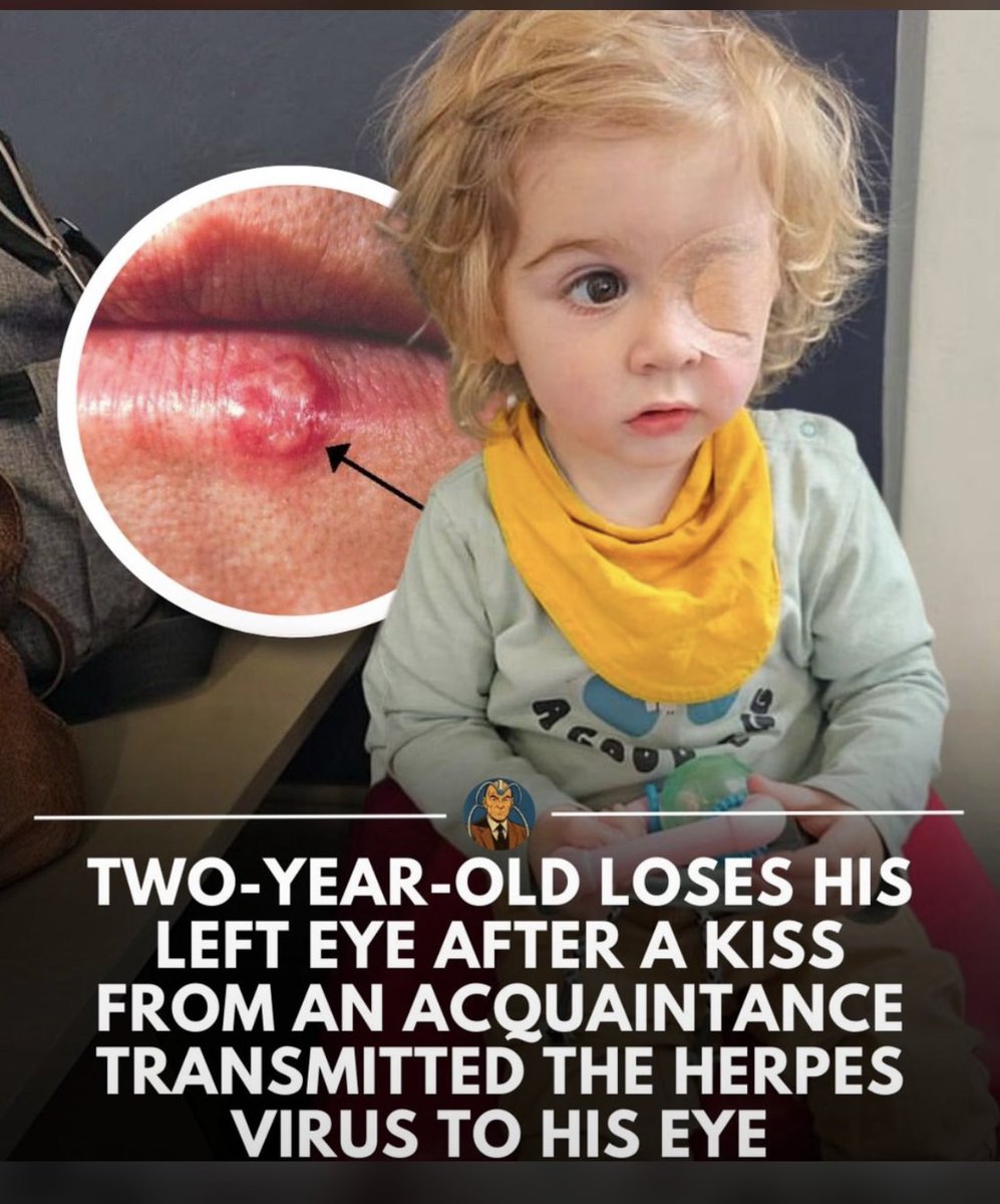 RegularD75's tweet image. A very devastated mother has urged parents to ban relatives and friends from kissing their babies after her toddler contracted a debilitating virus that cost him his left eye.
Two-year-old Juwan lost sight in the eve after a kiss from an S acquaintance rantee the herpes visto his…