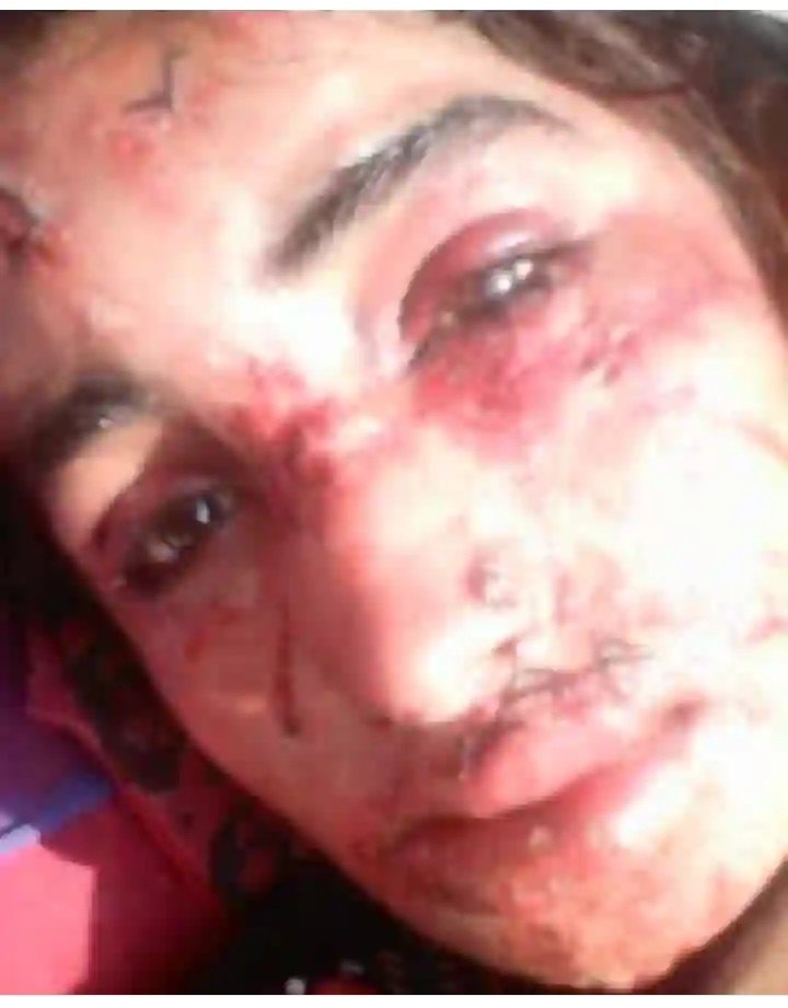 الله ڙي 😭😭
سانگھڙ چوٽياريون ٿاڻي جي حد ۾ ظلم بربريت وحشي وڏيري جي پٽ 14 سالن جي معصوم نياڻي حسنا بانو ملاح سان زبردستي زيادتي ڪرڻ بعد سڄي جسم کي بيلڊن جا چھير ڏئي زبان نازڪ عضوي تي پڻ تشدد ڪيو اھڙن وحشي ڪنڃر کي سرعام فاسي تي لٽڪايو وڃي !!