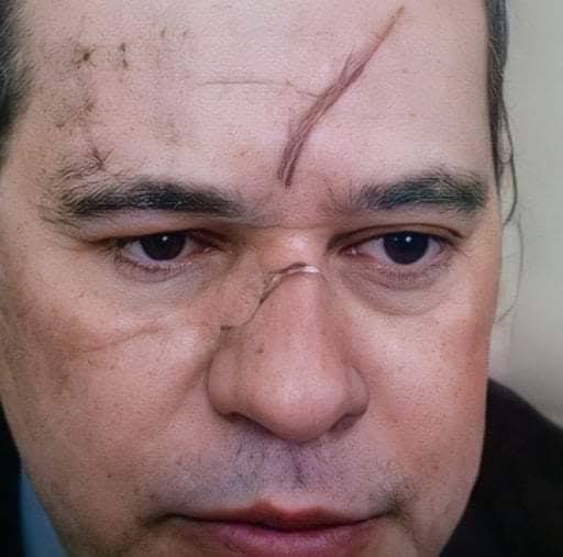 JoaquinTeixeira's tweet image. Quando eu bebo 28 latão no resort e perco tudo no cassino