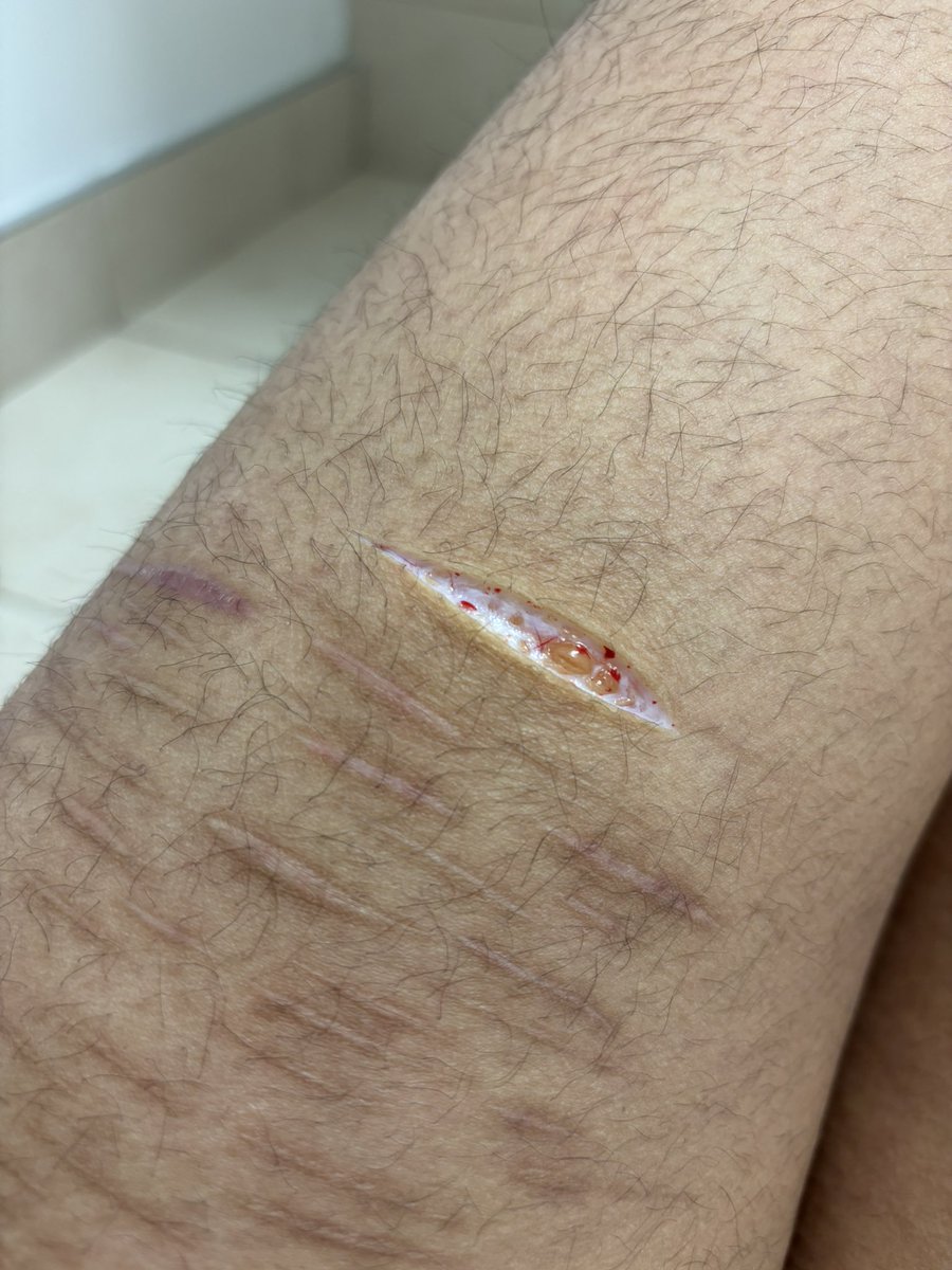 mack ⋆｡°✩ shedtwt tweet media