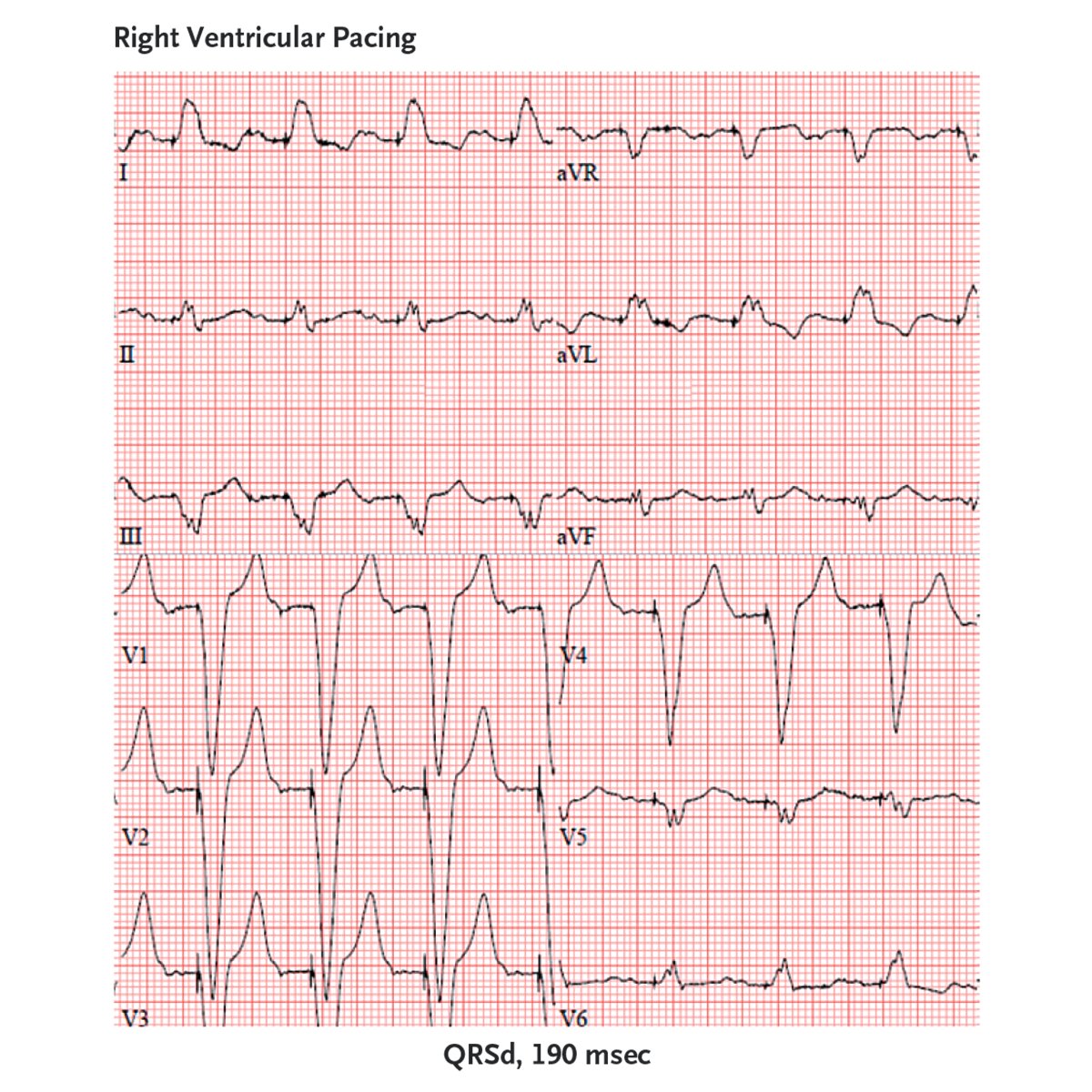 NEJM tweet media