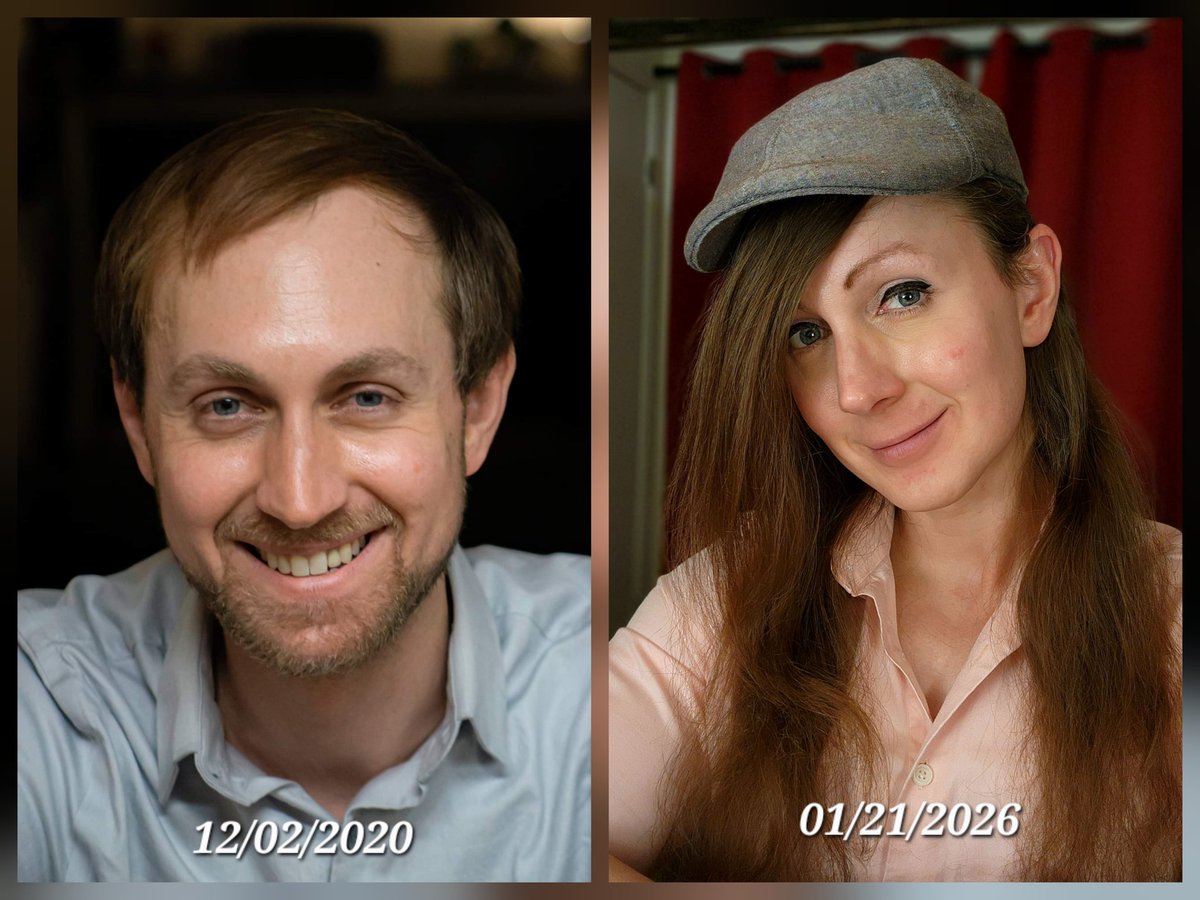 RealMacW's tweet image. 5 years of hormones does wonders for a person.