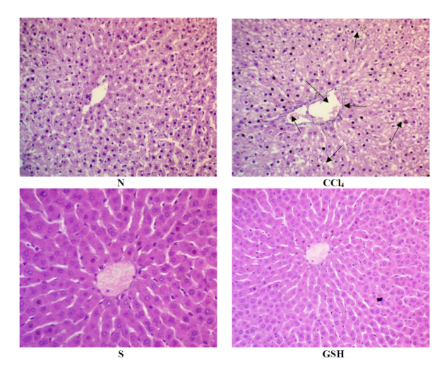 MicrobiomDigest's tweet photo. #ImageForensics
Each panel represents the liver of a differently-treated rat. Can you find the problem? https://t.co/cSws6GiOSM