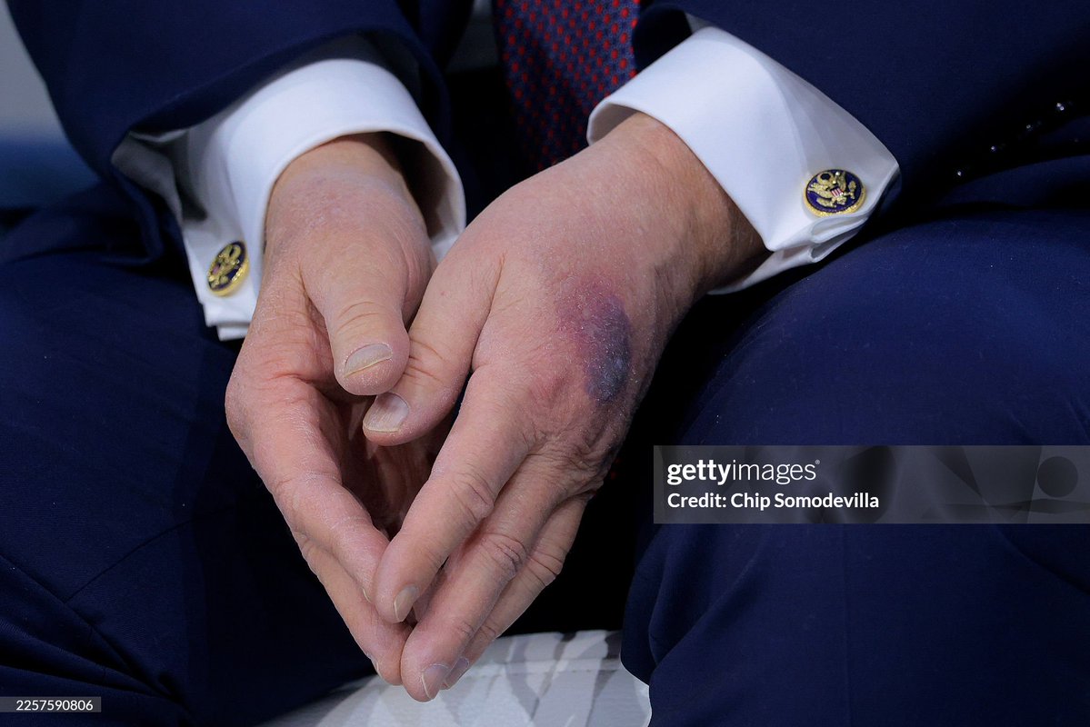 adagamov's tweet image. 🇨🇭 Трамп в Давосе