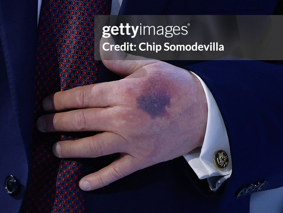 adagamov's tweet image. 🇨🇭 Трамп в Давосе