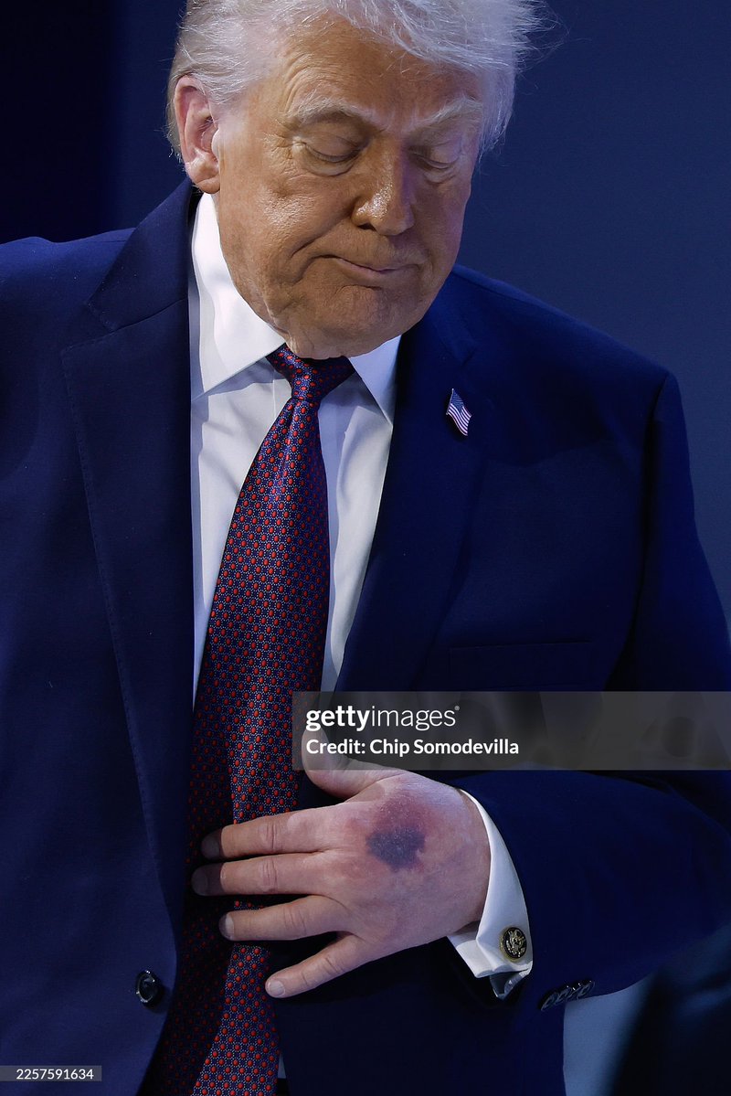 adagamov's tweet image. 🇨🇭 Трамп в Давосе