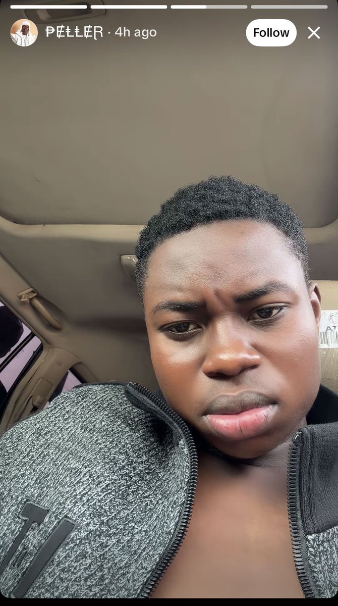 Peller e don do na 😢