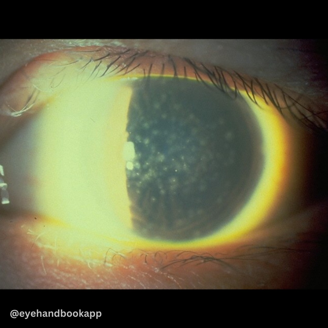 Eye Handbook tweet media