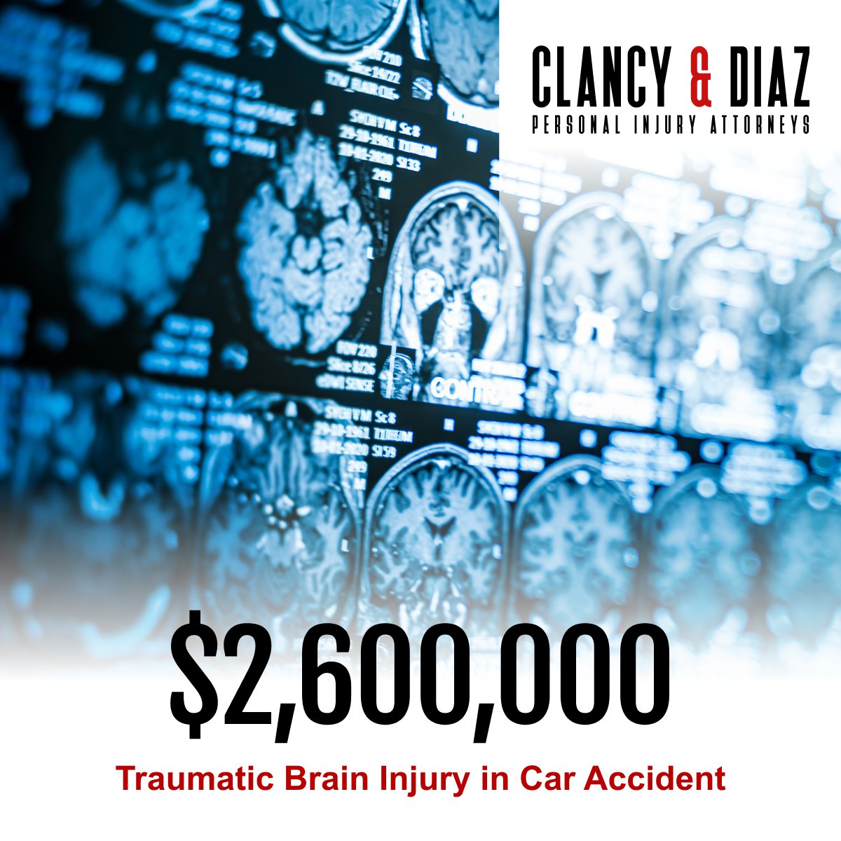 ClancyDiazLLP's tweet photo. A passenger suffered a severe traumatic brain injury after a crash ejected him from the vehicle. We secured $2,600,000 in compensation to help him and his family move forward after this life-changing accident.

Read more of our case results:
https://t.co/RrnYA6JeN5 https://t.co/9AqB4aKI7a
