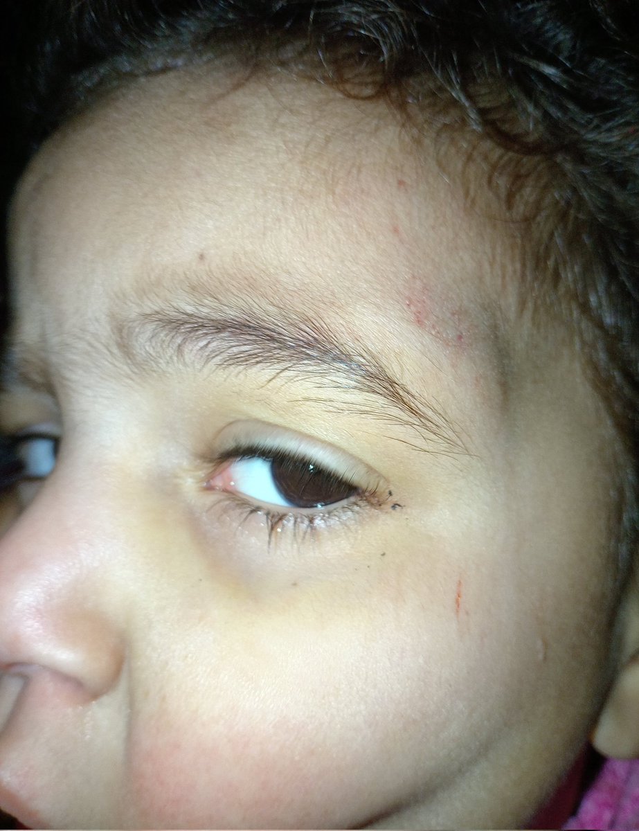 HE IS DYING
 
HELP ME 

HE IS DYING

I NEED MILK

HELP ME

HE IS DYING

I NEED MILK

HELP ME

HELP ME

I NEED MILK

I NEED $10

I NEED MILK 

I NEED MILK 

I NEED $10

HELP ME 

I NEED MILK

I NEED MILK

I NEED MILK

I NEED MILK

I NEED $10

I NEED MILK

chuffed.org/project/138194…