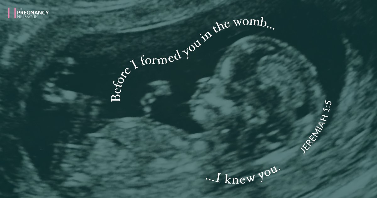 Today is #NationalSanctityofLifeDay 💓 Today we honor the unborn people who God knows and created in perfect detail.

➡️ 5 resources to share with your church: thepregnancynetwork.org/sohl