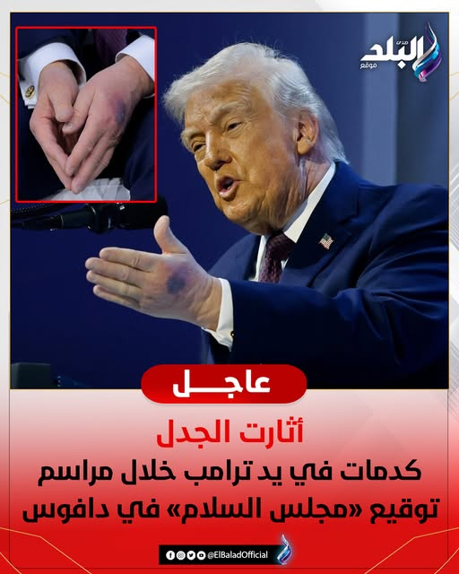 عاجل|| أثارت الجدل .. كـ. ـدمات في يد ترامب خلال مراسم توقيع «مجلس السلام» في دافوس 