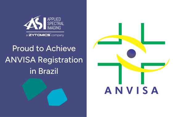 HiBand (BandView) is now ANVISA registered in Brazil.
This milestone enables Brazilian cytogenetics labs to adopt computer-assisted karyotyping with full regulatory compliance, supporting efficient, standardized routine diagnostics.
#ANVISA #Brazil #Cytogenetics #Karyotyping #ASI