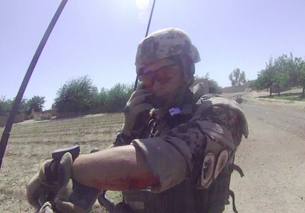 CasparStefani's tweet image. Damn IED. It got me right behind the front lines.