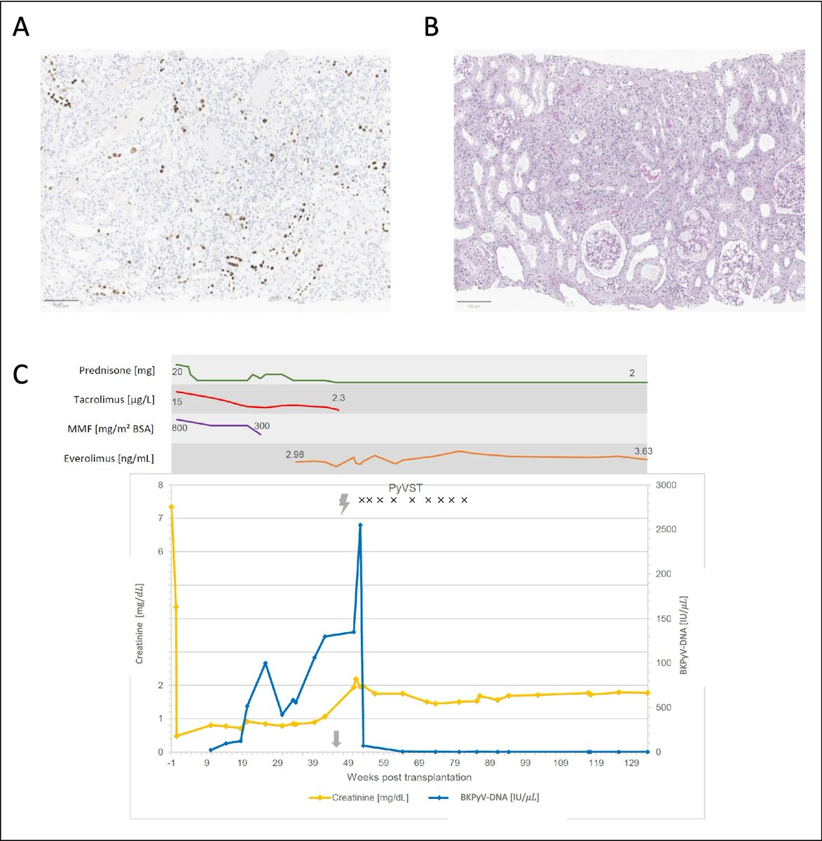 Pediatric Nephrology tweet media