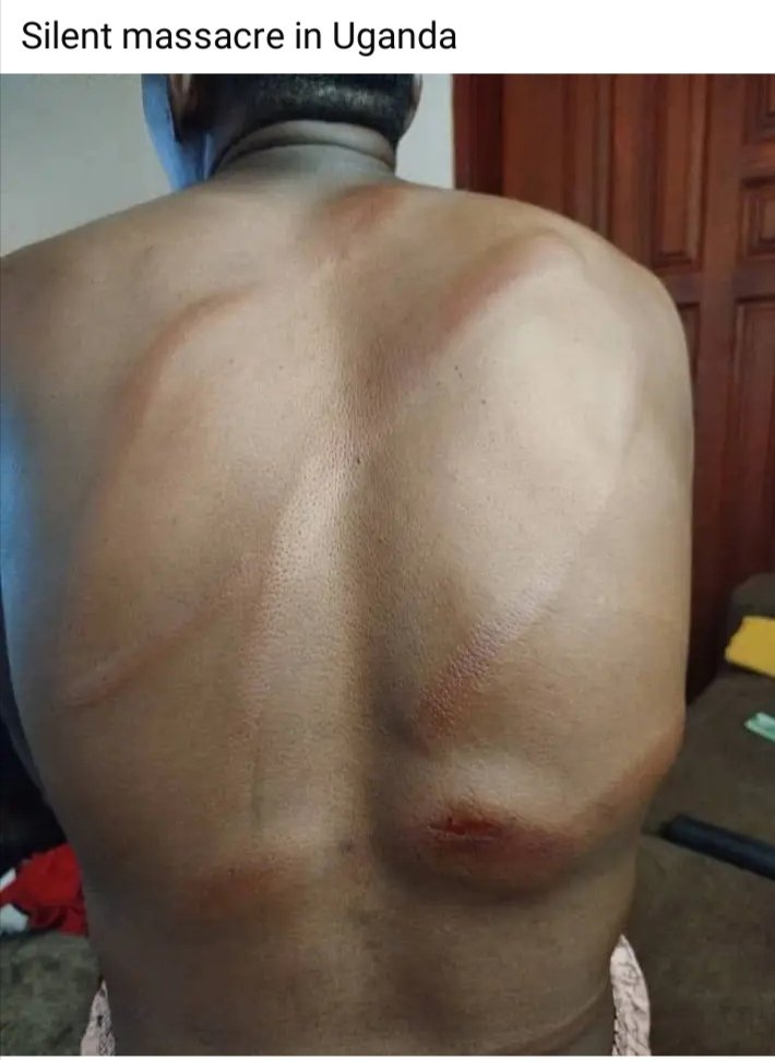 RuthNnyanye's tweet photo. @mkainerugaba Just stop doing this to our brothers and sisters https://t.co/kudzIKgyDI