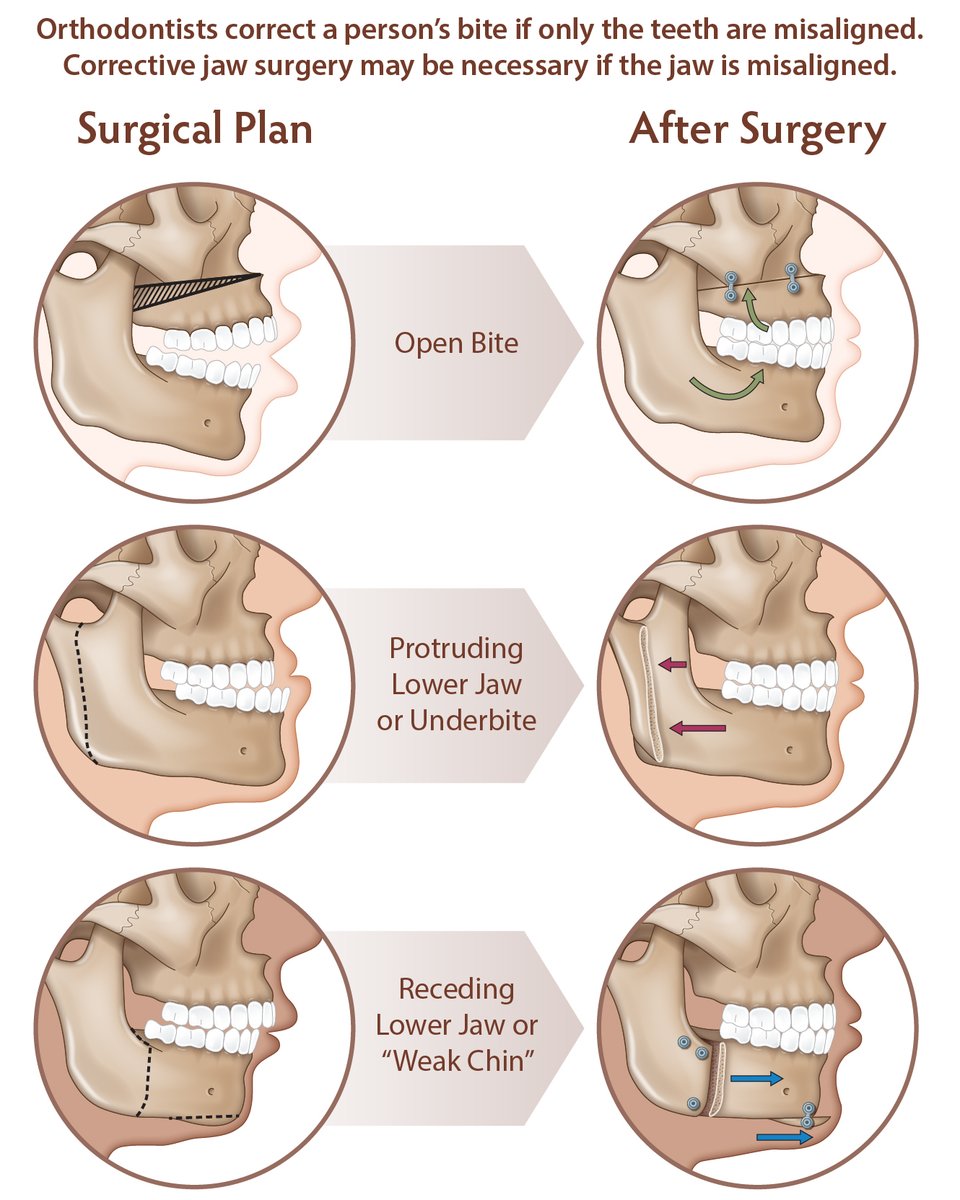 AAOMS - Oral and Maxillofacial Surgeons tweet media