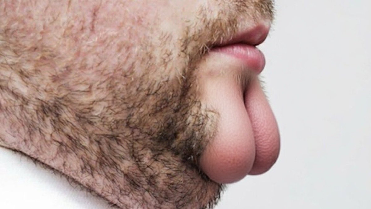 “Testicle is never going to $5”