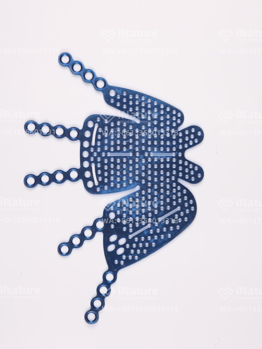 tianyun2022's tweet image. 🦴Type 3 orbital plate

✅Effective medial support
✅Excellent stability
✅Anatomical fit
📩Message us now for product details and pricing!

#maxillofacial #ShoulderjointandHumerusLockingPlate #LockingPlate #TraumaOrthopedics #Fracturefixation #Orthopedicsurgery