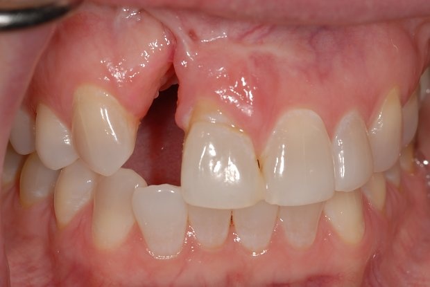 🍏Signal🍏🍃🚬PREP TO OPEN COMM tweet media