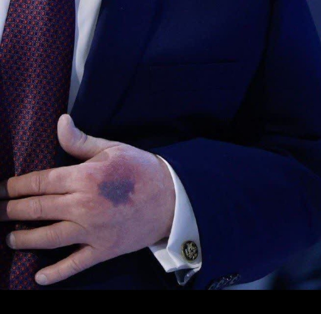 🔸️زردک رذل ، هی.ت.لر زمان 
ان شاالله به امید حق از همین جای دستت
شروع به پوسیدن و نابودی کنی و بزودی مثل یه میوه گندیده بری تو زباله دونی .
دنیا رو بهم ریختی 
نامرد روزگار .