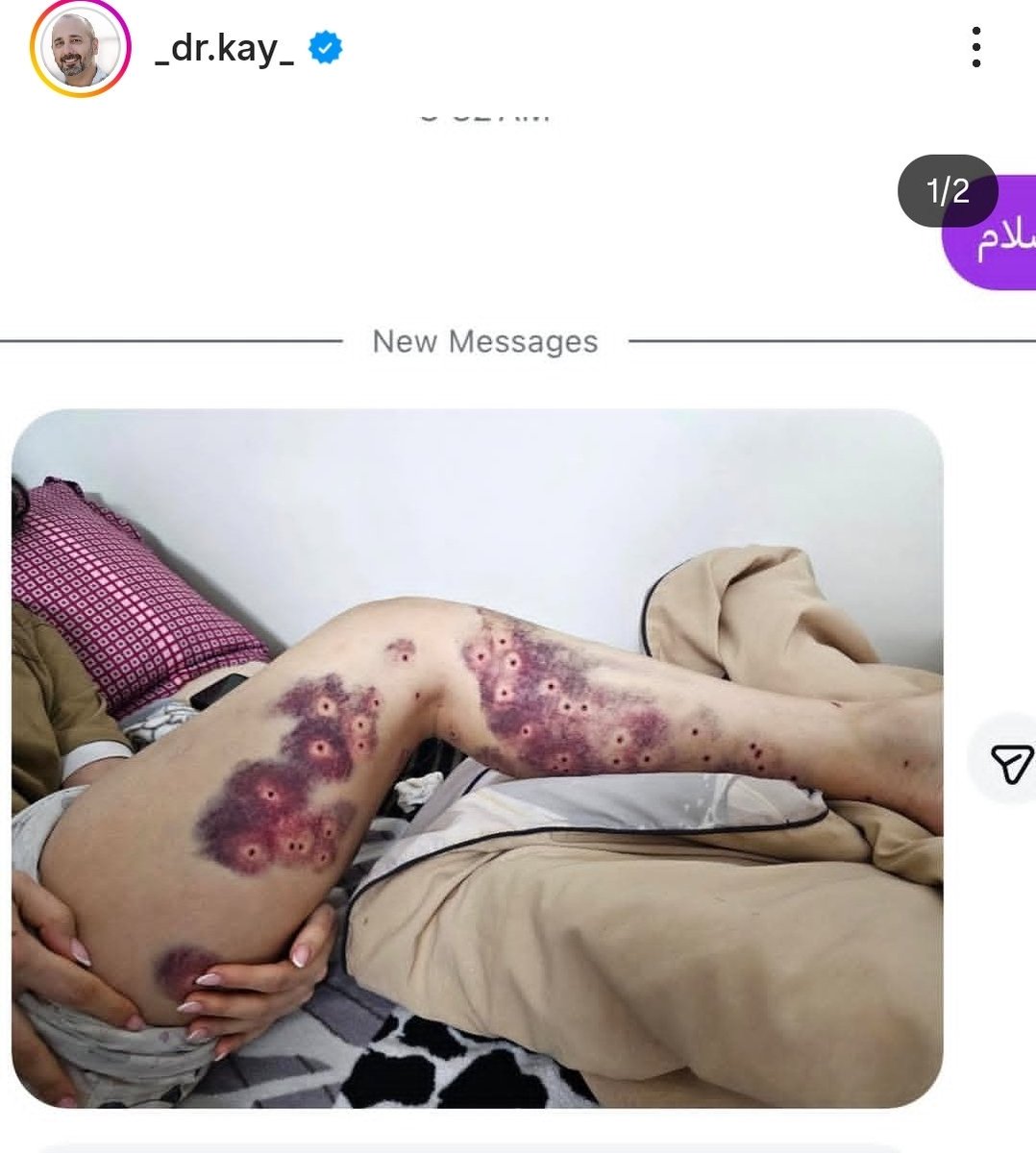 ItsAnotherWish's tweet image. ببینید چه بلاهایی سر مردم اوردن 😭😭😭
مردم از ترس نمیتونن برن پیش پزشک و بیمارستان