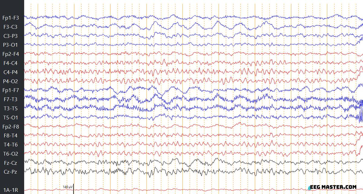EEG Master tweet media